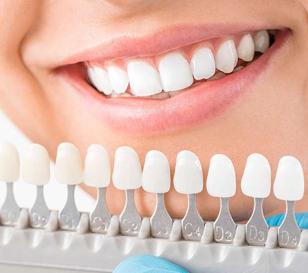 Chamblee Cosmetic Dentist