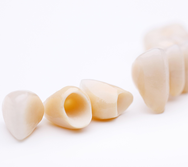 Chamblee Dental Crowns