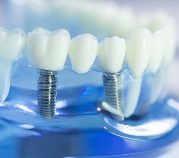 Chamblee Dental Prosthetics