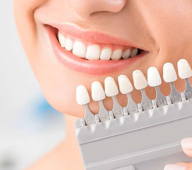 Chamblee Veneers