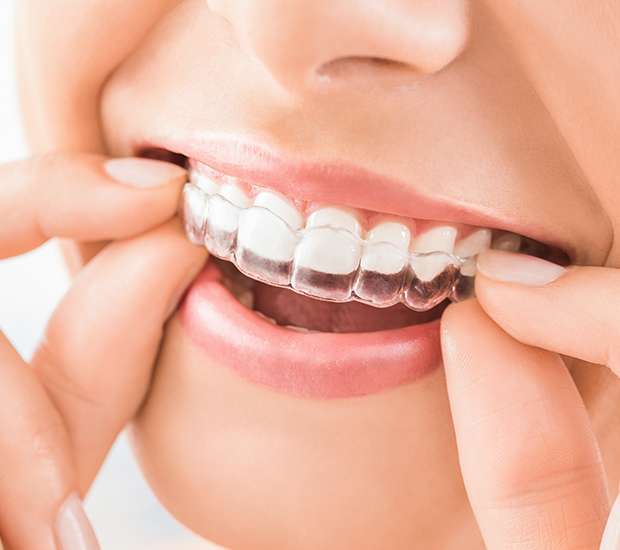 Chamblee Does Invisalign® Really Work?