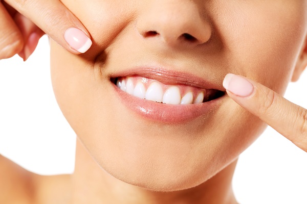 Teeth Whitening FAQs