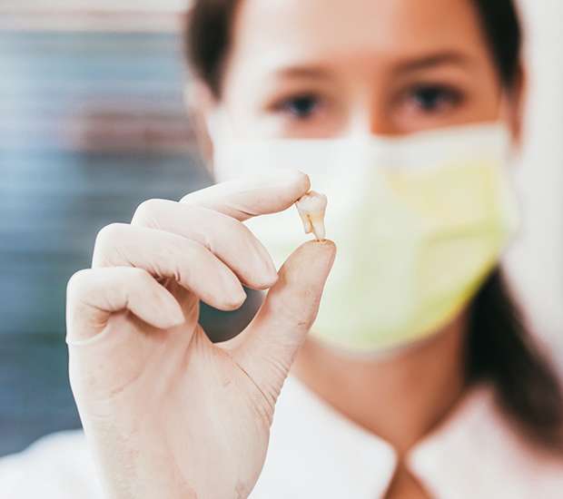 Chamblee Tooth Extraction